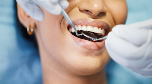 Best Emergency Gum Treatment in Republic, PA